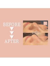 クリアラボ 豊中(Clear Lab)/Before&After