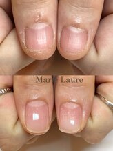 マリーロール 梅田店(Marie Laure)/自爪育成/深爪矯正/ネイルケア