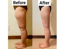 スイ(sui)の雰囲気（写真と体組成計で管理！3年かけてリバウンド知らずの身体へ。）