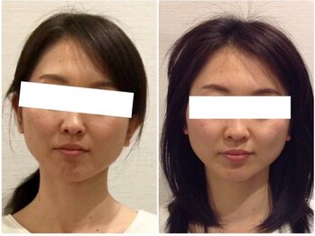 ウェリナ平和堂長久手院/小顔矯正/骨盤矯正/痩身/整体