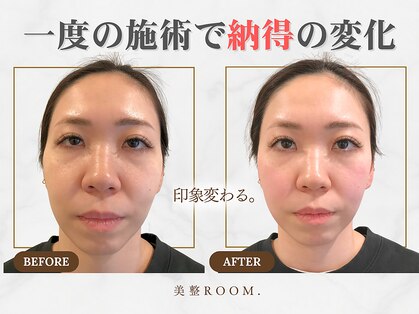 美整ルーム 横浜店(美整ROOM)の写真