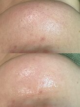 グリーン(green)/アゴは自分じゃよく見えないけど