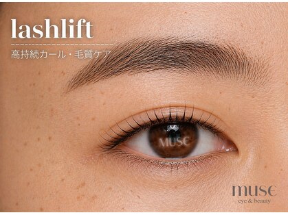 ミューズ(MUSE)の写真