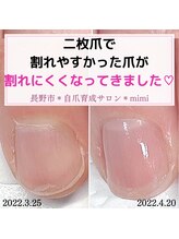 ミミ(mimi)/二枚爪が割れにくくなりました！