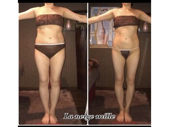 ラネージュミル(La neige mille)/インキュア痩身