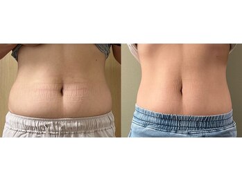 ココア(CoCoa)/トレーニング×最新マシン