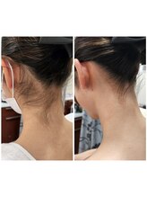 ウェンディ(Wendy)/シェービングの施術【うなじ】