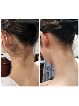 ウェンディ(Wendy)/シェービングの施術【うなじ】