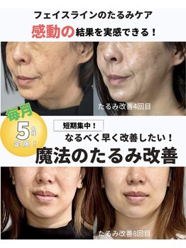 ハス(hasu.)/たるみ改善初回体験