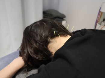 ビーロイヤル(B-ROYAL)/首こり肩こりにお悩みの方にも!