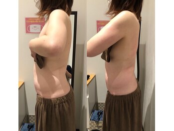 フォルチェ 春日(Folche)/体の厚み/お腹/腰/二の腕