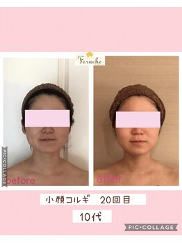 小顔コルギ専門店 フェルーシュ 成田駅前店(Feruche)/小顔コルギ計10回(20代女性)