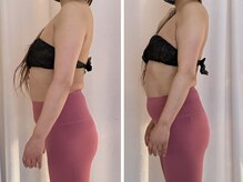 ビューティールーム リヴィア(BEAUTY ROOM RIVIA)/反り腰巻き肩も調整¥15400