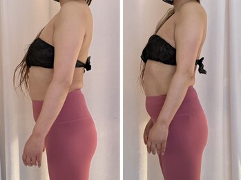 ビューティールーム リヴィア(BEAUTY ROOM RIVIA)/反り腰巻き肩も調整¥15400