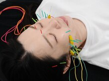 フロー鍼灸整体院(FLOW鍼灸整体院)/美容鍼灸