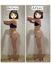 未来型スパエステ サリスパ(SARI SPA)/ビフォーアフター