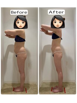 未来型スパエステ サリスパ(SARI SPA)/ビフォーアフター