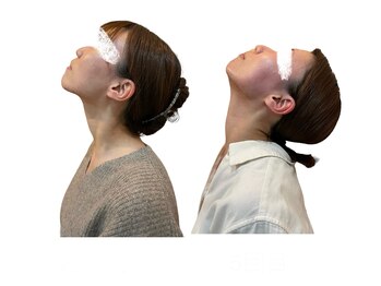 ブラーヴァ(Brava)/ビフォーアフター