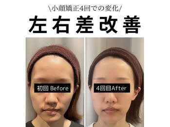 キュープ 鹿児島伊集院店(Qpu)/