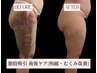 【体験はこちら★】仕上がりに差がつく！術後ケアモニター！3回券 ￥10,000
