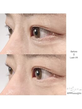 アトリエ プラス リム(atelier +LIM)/ラッシュリフト/まつげパーマ