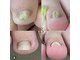 ベルタネイル(BELTA NAIL)の写真