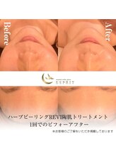 エスプリ 銀座店/ハーブピーリング銀座