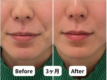 ホープ鍼灸整骨院/10回の施術結果です！