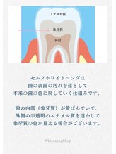 ホワイトニングショップ 横手店/