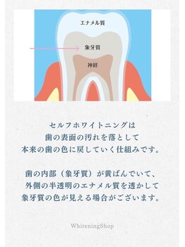 ホワイトニングショップ 横手店/