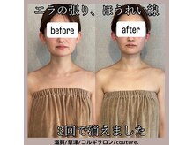 クチュール(couture.)/3回目after