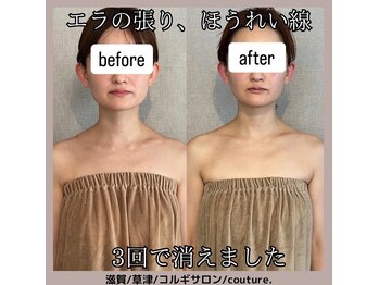クチュール(couture.)/3回目after