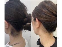 ミース 久留米店/うなじ脱毛体験1回目！