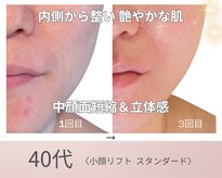 リアン(Lien)