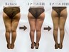 【お得な3回券】3種のマシンで脂肪撃退！ネオスリム最強痩身100分