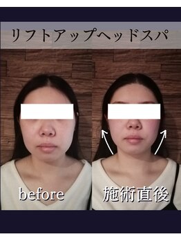 ヘッドラボ(Headlabo★3103)/リフトアップヘッドスパ
