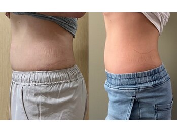 ココア(CoCoa)/トレーニング×最新マシン