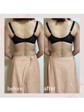 セレーネ(Selene)/お客様before.after