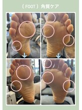 プティットスリール 西尾店(Petit Sourire)/角質ケア*かかと*足裏*甘皮ケア*