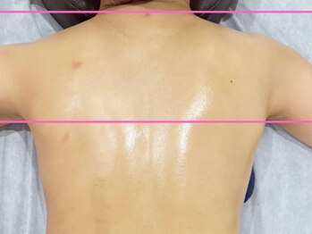 エスナ/【見えない背中もバッチリ☆】