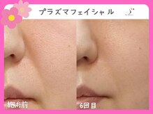 ソーハート(So Heart)/☆大人気！エイジングケアに特化