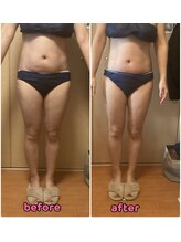 カラーリリー(calla lily)/スリムシェイプ全身