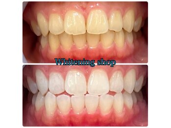 ホワイトニングショップ 那覇店