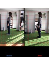 アイボディ(aibody)/お客様のビフォーアフター