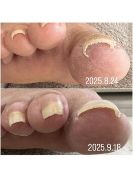 ケア ビューティー ネイル(care beauty NAIL)/