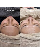 ラシンバン(Lashinvan)/ララピール