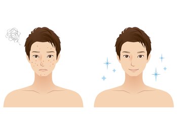 ヴィーダ(VIDA)/ＬＤＭ水玉リフティング導入