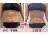 【人気No2★ペタンコお腹】強めリンパ痩身+筋膜+腸もみで最強くびれ70分