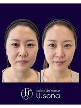 サロン ド ナース ユーソナ 松本店(salon de nurse U.sona)