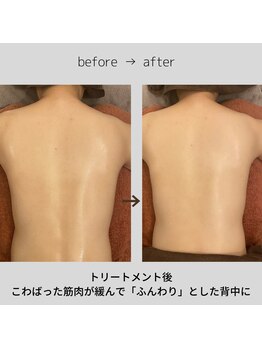 リラクゼーションルームトフレ(relaxation room toefre)/